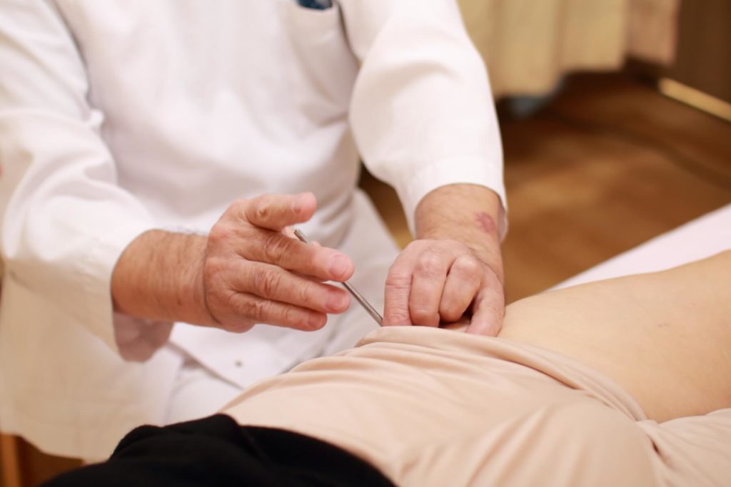 鍼による治療の様子02