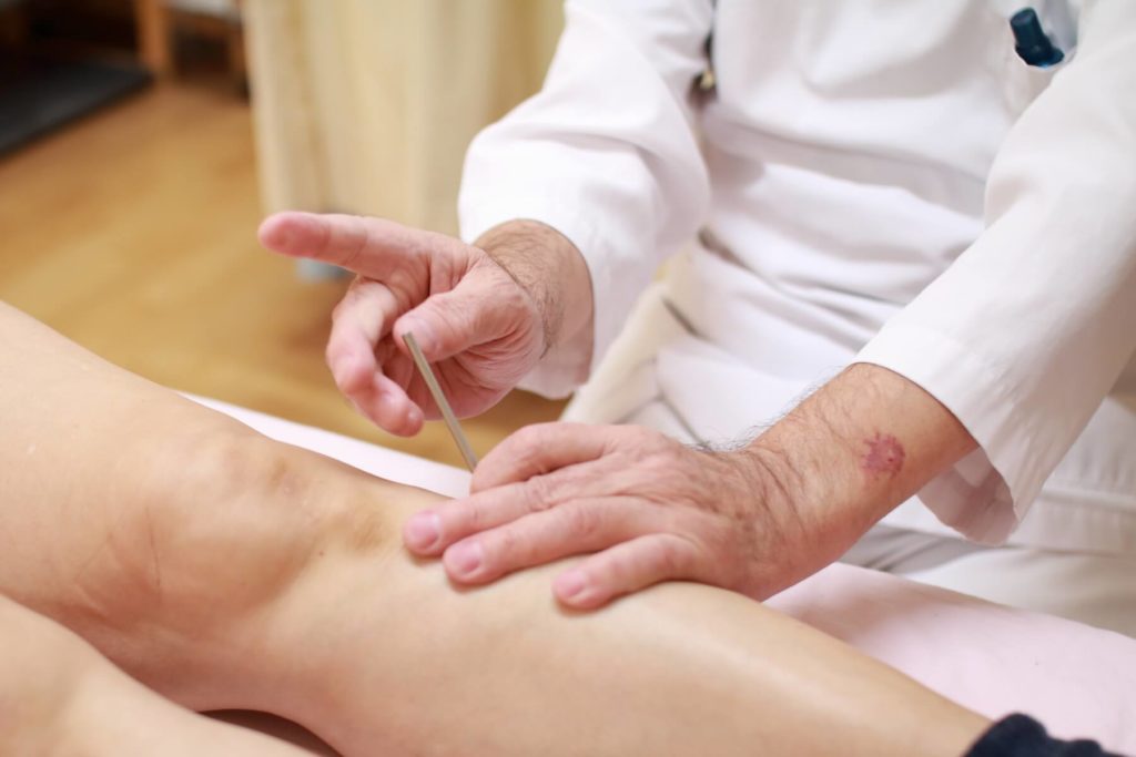 鍼による治療の様子03